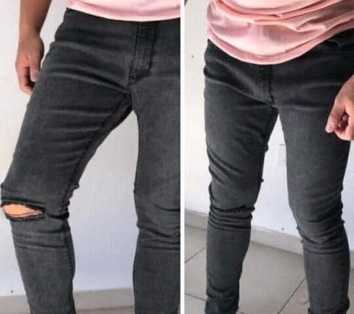 jean alex negro con rotura en la rodilla